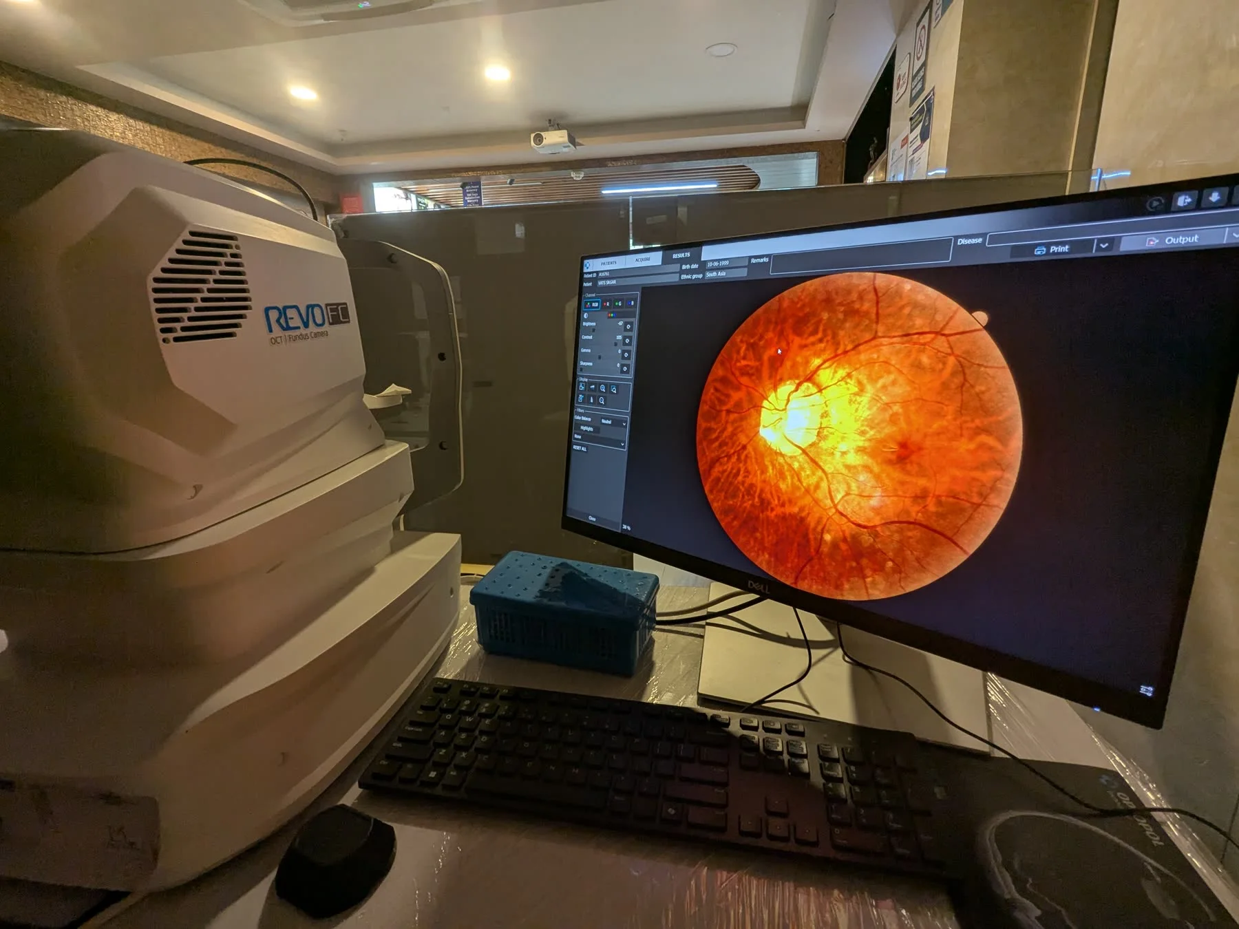 Retinal imaging equipment and fundus photograph at Rana Eye Centre