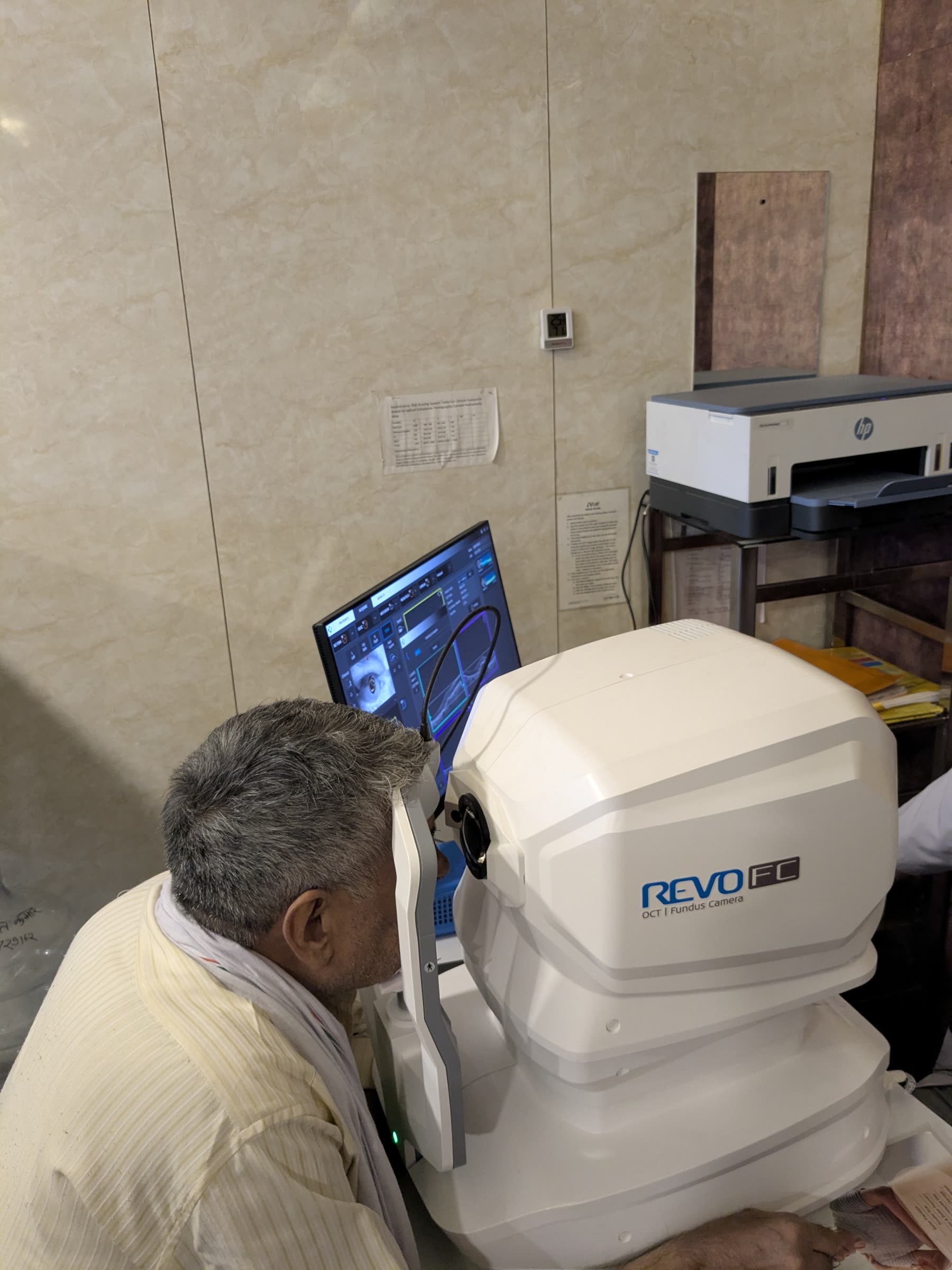 Optical Coherence Tomography at Rana Eye Centre