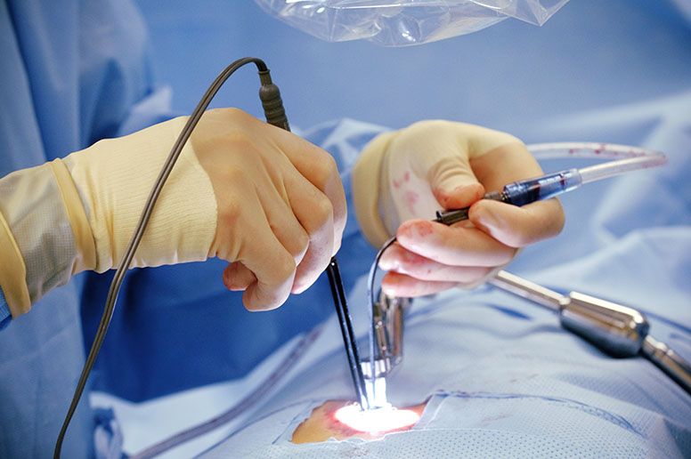 DCR Surgery in Prashant Vihar