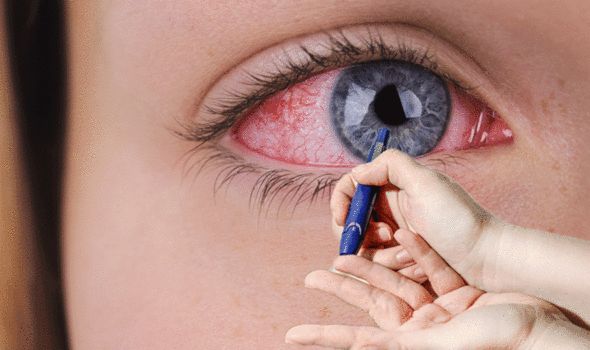 Diabetic Retinopathy Treatment in Shalimar Bagh